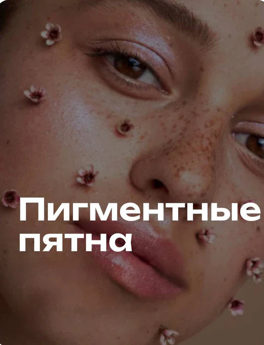 Пигментация