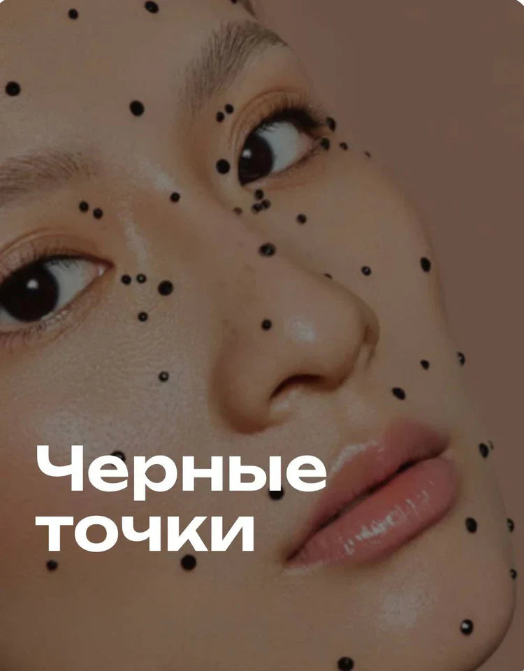 Черные точки